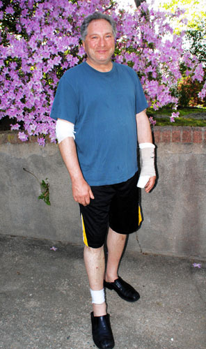 Hailed as hero in Pelham Bay pitbull Attack