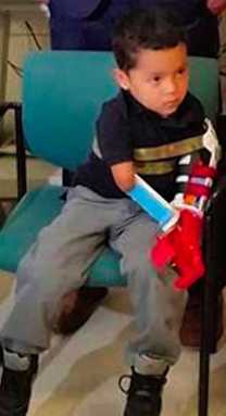 Jacobi 3D prints arm for youngest patient