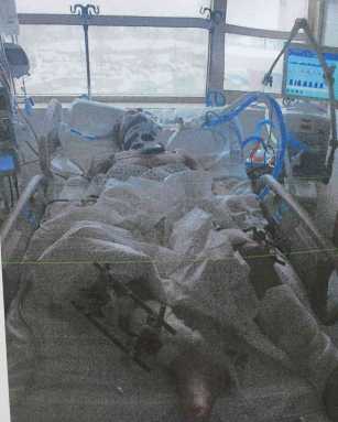 Throggs Neck ‘hit and run’ victim makes steady recovery|Throggs Neck ‘hit and run’ victim makes steady recovery|Throggs Neck ‘hit and run’ victim makes steady recovery