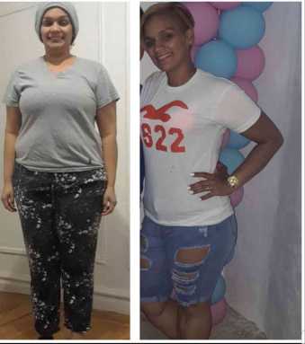 Over 200 bariatric surgeries for Jacobi Hospital last year