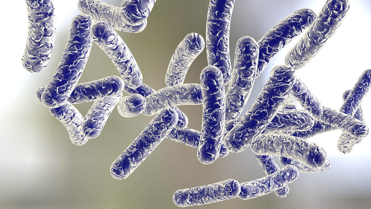 legionnaires disease