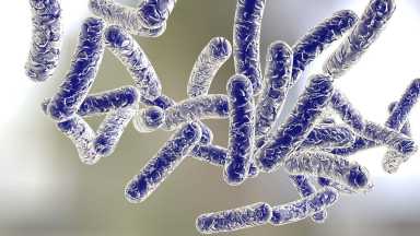 legionnaires disease